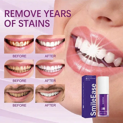 HISMILE V34 Teeth