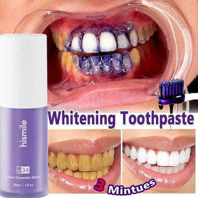 HISMILE V34 Teeth