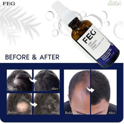 Feg Plus Hair Growth Spray – Stimulate Follicles, Reduce Hair Fall, And Encourage Thicker, Healthier Growth 60ml