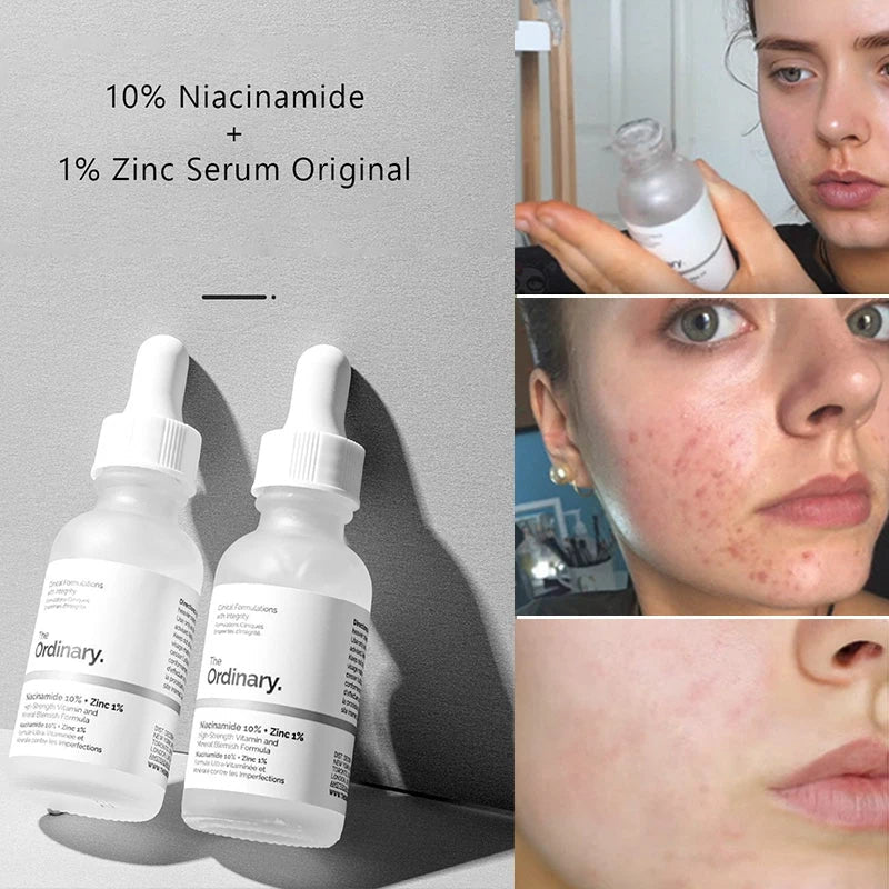 The Ordinary Niacinamide Serum 10% + Zinc 1% Supersize Serum | Best Quality Serum 30ml